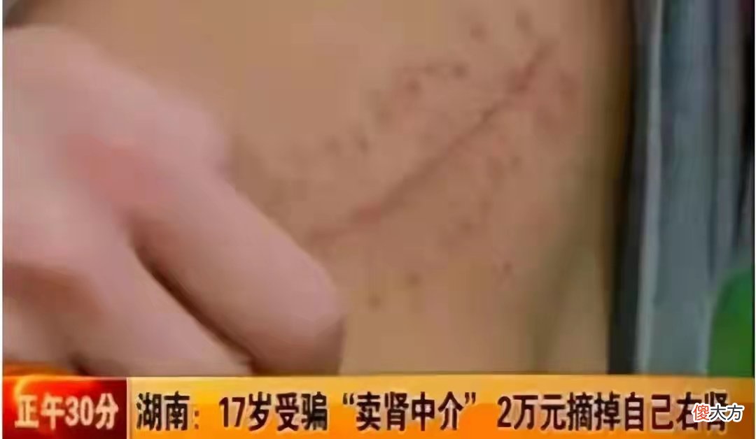 卖肾买苹果手机的少年 那个卖肾买iphone的少年