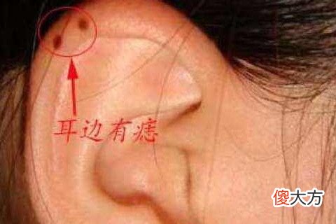 女人耳后有痣代表什么