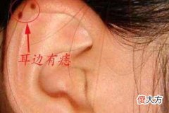 女人耳朵长痣的命运怎么样