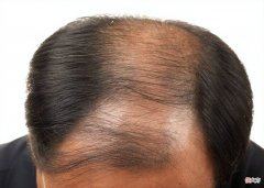 4种物质可以辅助改善睡眠质量 改善睡眠的物质