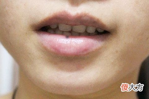 女人嘴唇有痣面相图解大全