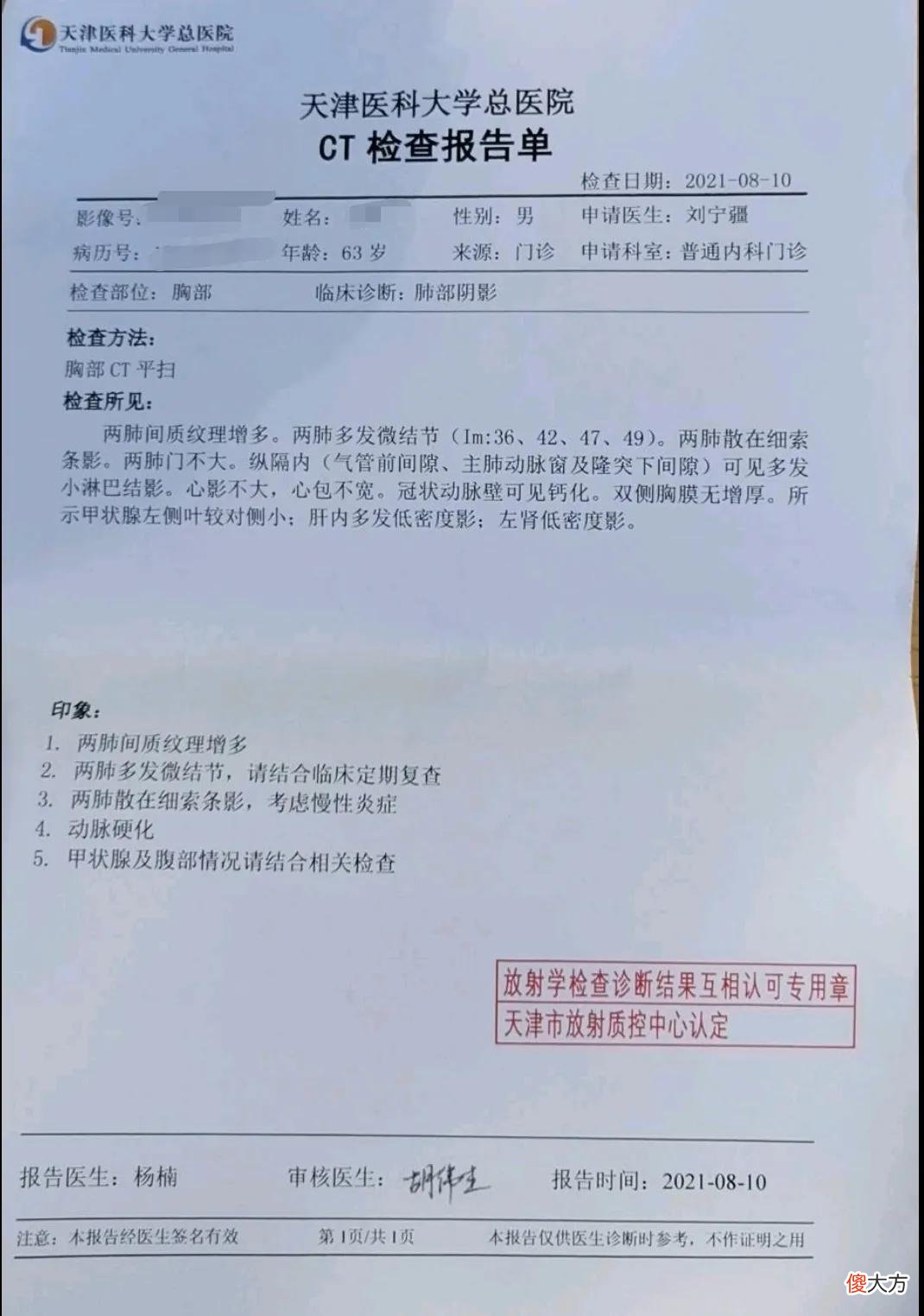 手机和电脑看片子哪个好 手机和电脑看电影哪个效果好
