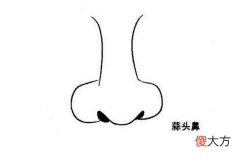 蒜头鼻面相解析