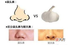 蒜头鼻面相究竟好不好