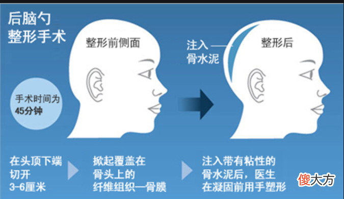 整容真的可以得到你想要的吗 整容真的能整成自己想要的样子吗