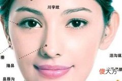 体弱命短的女人面相特征
