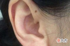 耳朵上有痣好不好