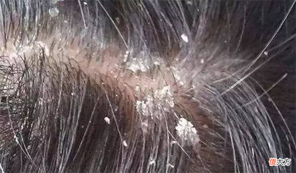 洗发水的种类和选择 洗发水选哪种