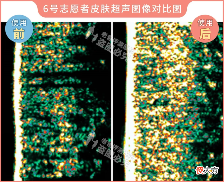网红家用美容仪真的有效吗 家用美容仪真的有效吗?
