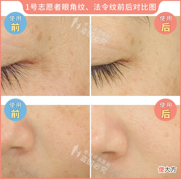 网红家用美容仪真的有效吗 家用美容仪真的有效吗?