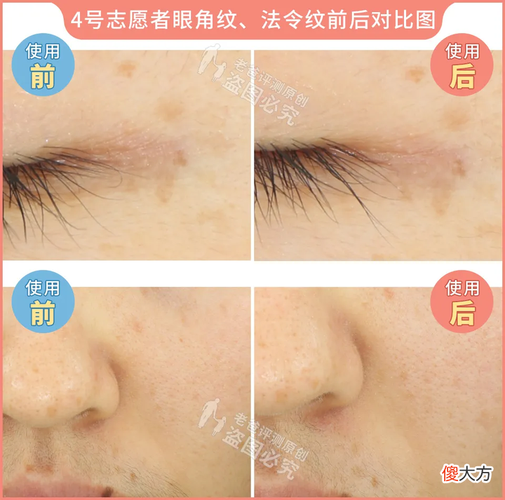 网红家用美容仪真的有效吗 家用美容仪真的有效吗?