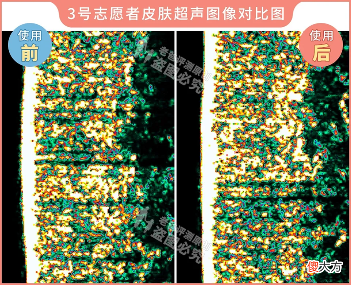 网红家用美容仪真的有效吗 家用美容仪真的有效吗?