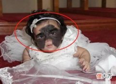 女孩出生后满脸胎记，被称蝙蝠女婴，7次手术后终化茧成蝶