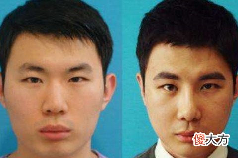 男人颧骨高面相算命