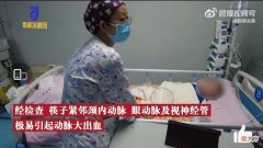 2岁幼童颅内插入筷子险丧命！家里这6类不起眼的东西，千万让娃远离！