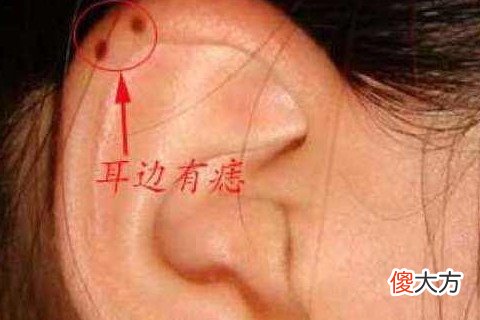 女人耳朵有痣图解大全
