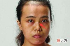 四种命苦的女人面相看你是吗