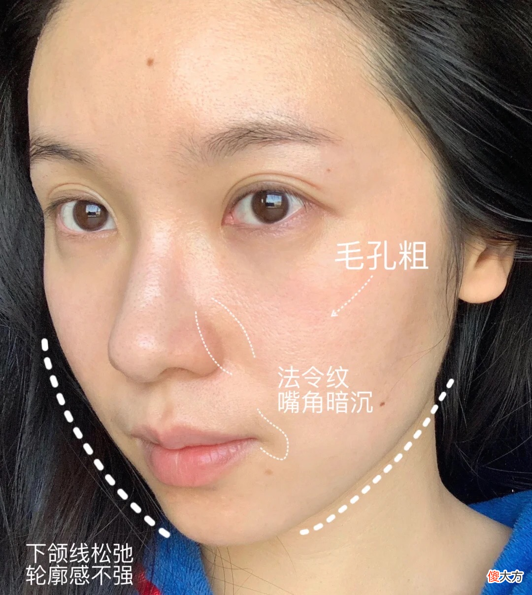 小棕瓶是其一 小棕瓶是玻璃瓶