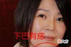 下巴有痣的女人有什么不好吗
