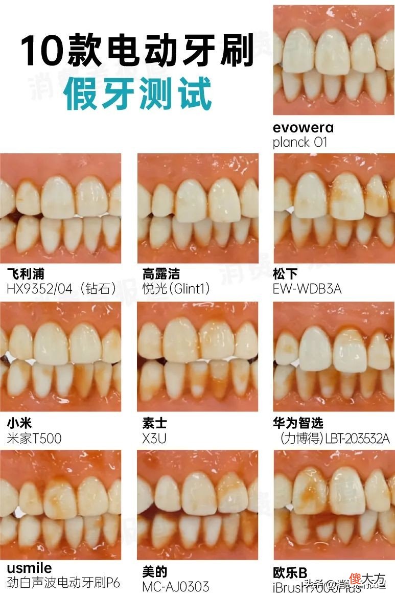 10款电动牙刷对比报告：1000元与100元差距在哪儿？消费者该怎么选？