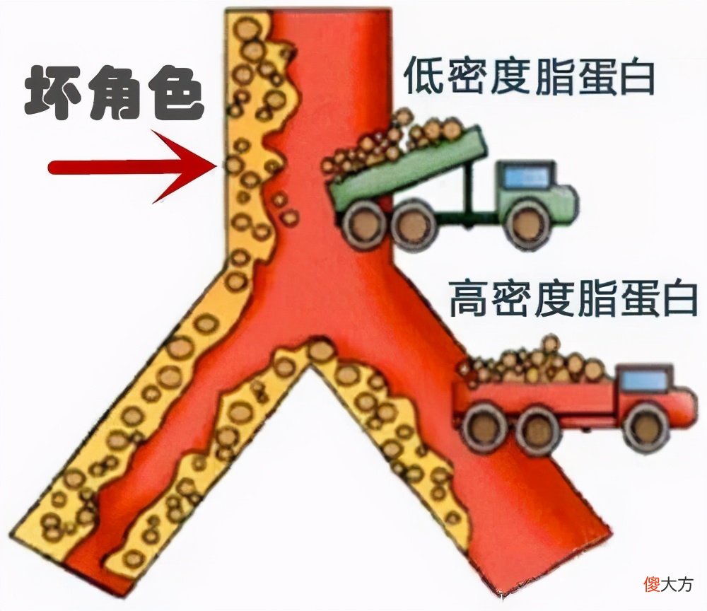 胆固醇会升高吗 喝酒胆固醇会升高吗