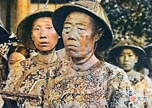【历史故事】李莲英一彩照曝光：脸上长满脓包，为何慈禧还那么信任他？