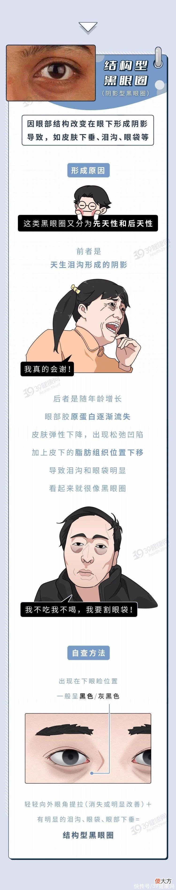 【就爱时尚】每天要睡几小时，才能把黑眼圈睡没？