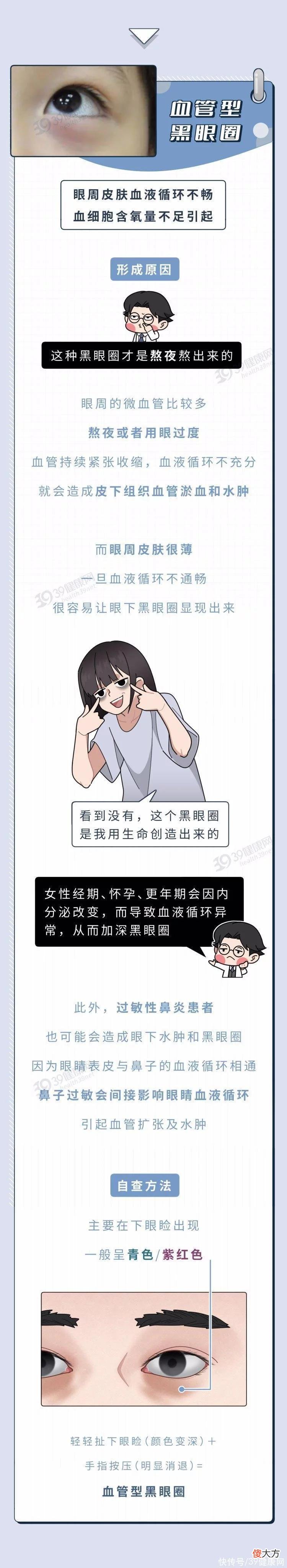 【就爱时尚】每天要睡几小时，才能把黑眼圈睡没？
