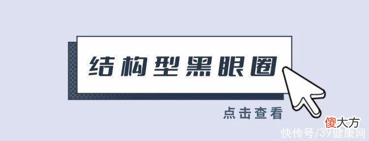 【就爱时尚】每天要睡几小时，才能把黑眼圈睡没？