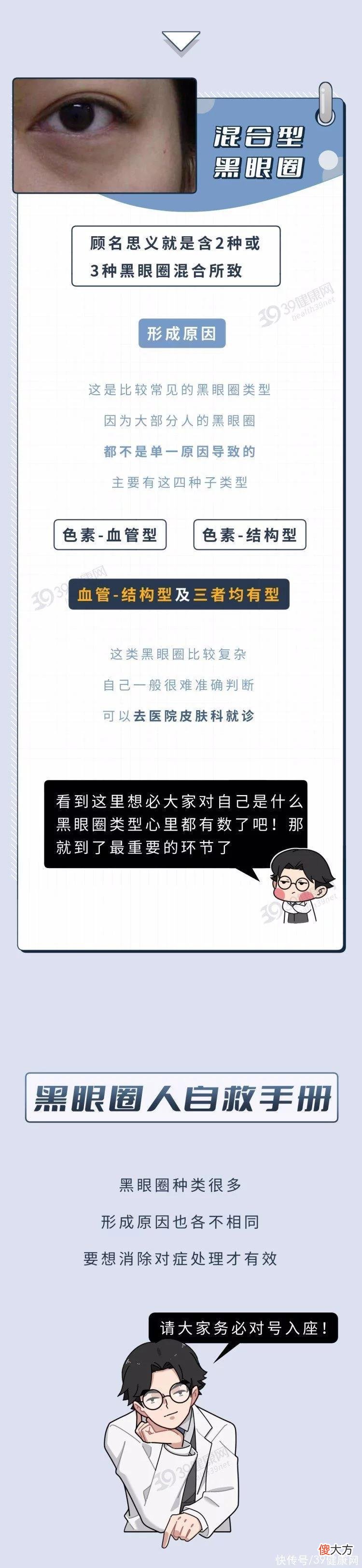 【就爱时尚】每天要睡几小时，才能把黑眼圈睡没？
