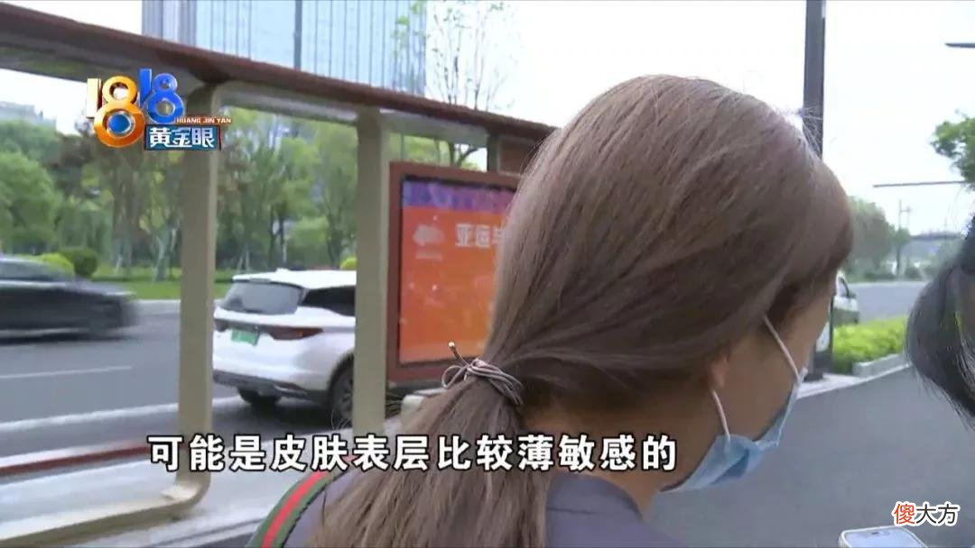 【时尚一点】婚礼计划被打乱 又红又痛很“煎熬”