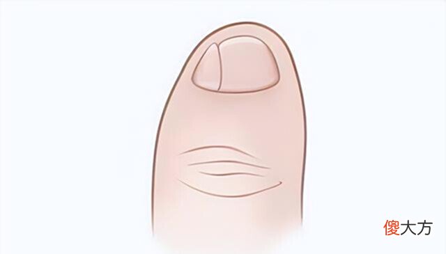 【爱历史】你的小脚趾如果有两瓣趾甲,可能不是纯正的汉人,而是他们的后代
