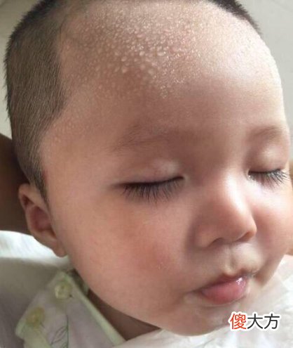宝宝睡觉时“大汗淋漓”，是因为缺钙吗？