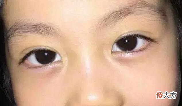 “孩子积食，脸先知”，若面部没有这4个表现，恭喜孩子脾胃还不错