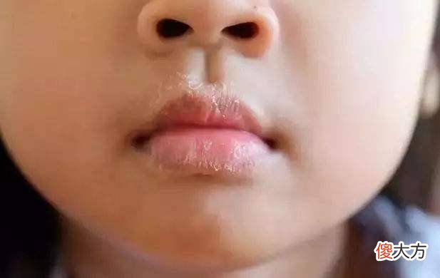 “孩子积食，脸先知”，若面部没有这4个表现，恭喜孩子脾胃还不错