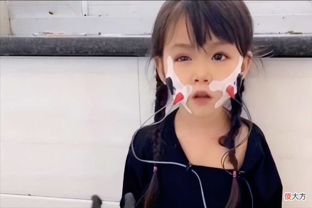 “折翼天使”蓝妮妮：虽有倾国倾城的美貌，却身患疾病，无法像正常人一样生活