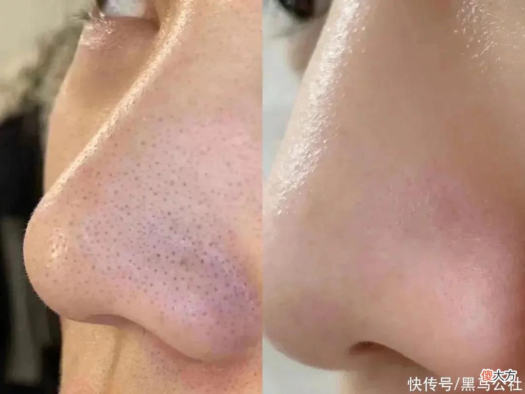 【时尚一点】39.9/3瓶！洗出脏东西，男人不油腻，夏日清爽必备！
