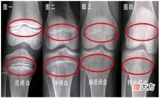 孩子身高的“助长剂”发现了，不是牛奶，若孩子爱吃，个子不用愁