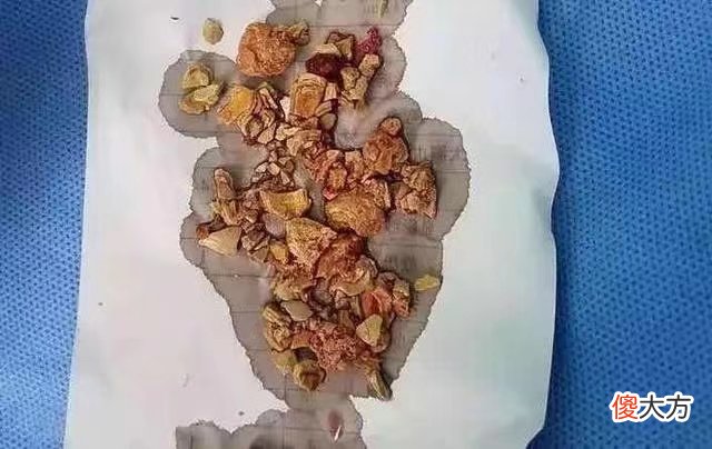 宝宝添加辅食，牢记8个原则，让孩子吃得好更健康