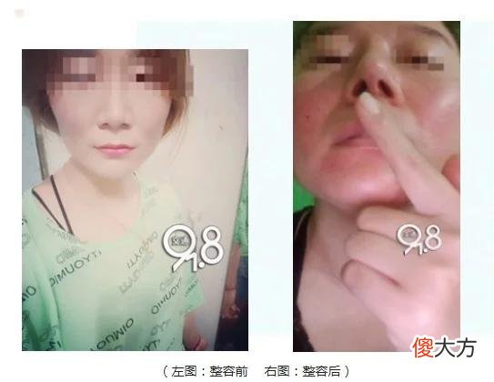 【就爱时尚】姑娘为入职KTV去整形，结果一边大一边小还歪了