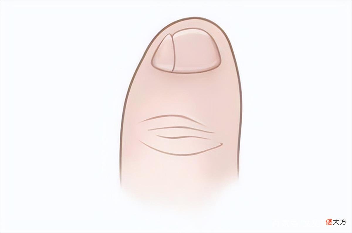 【历史故事】如果你的小脚趾有两瓣指甲，也许不是纯正汉人，而是他们的后代
