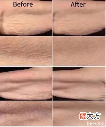 【时尚一点】扒皮！VC是神仙成分还是伪科学