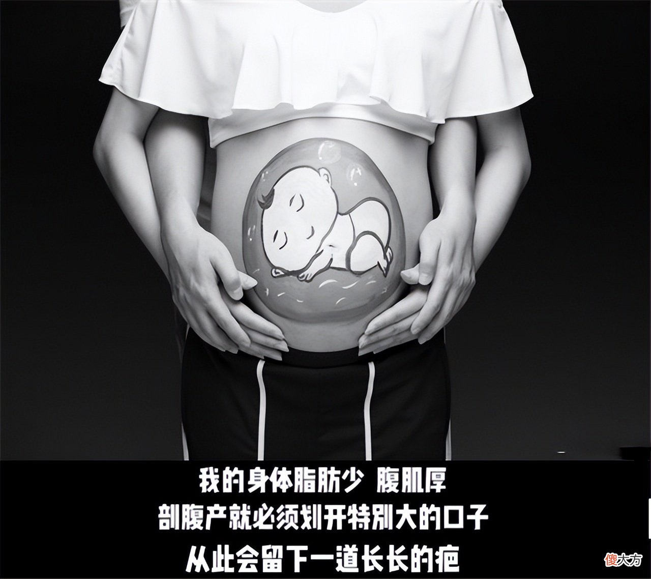 吴敏霞公开生产细节，三年经历两次剖腹产！肚子上疤痕好明显