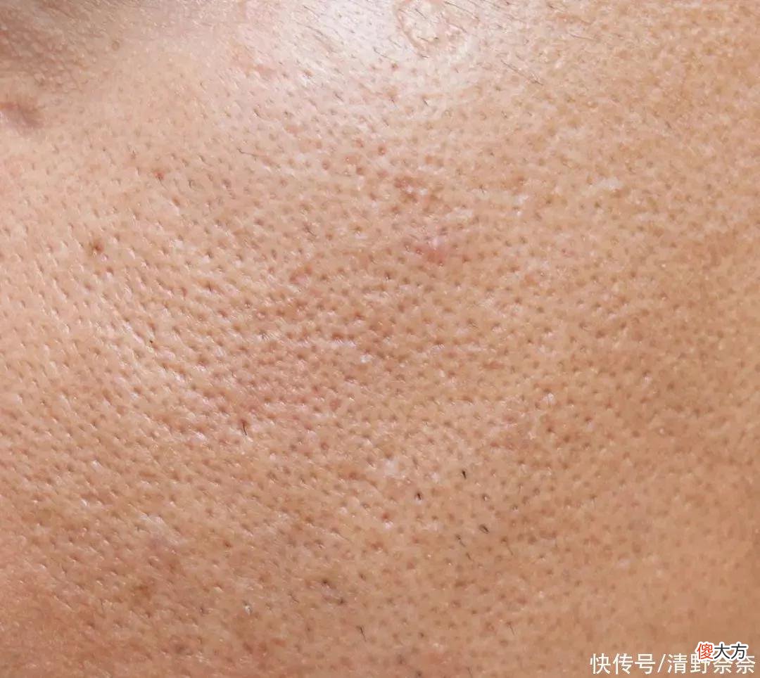 【就爱时尚】大毛孔务必看过来！DW类持妆粉底上妆技巧
