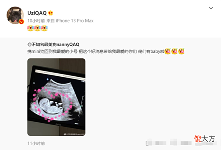 【游戏世界】Uzi夏季赛休息，原来是喜得一子？奥咪咪向粉丝分享喜悦！