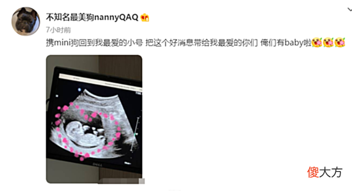 【游戏世界】Uzi夏季赛休息，原来是喜得一子？奥咪咪向粉丝分享喜悦！
