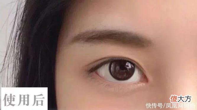【就爱时尚】长了脂肪粒到底挤不挤？一分钟教你处理它的正确方式
