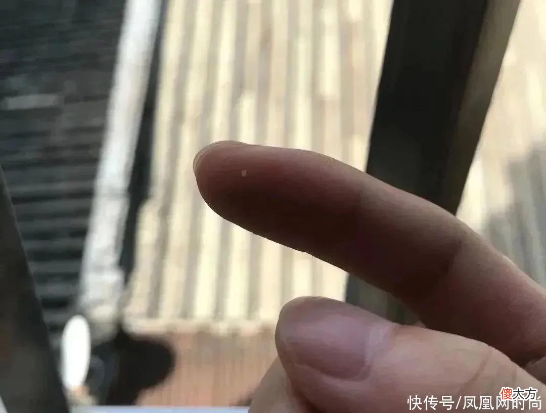 【就爱时尚】长了脂肪粒到底挤不挤？一分钟教你处理它的正确方式