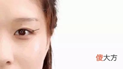 【就爱时尚】长了脂肪粒到底挤不挤？一分钟教你处理它的正确方式