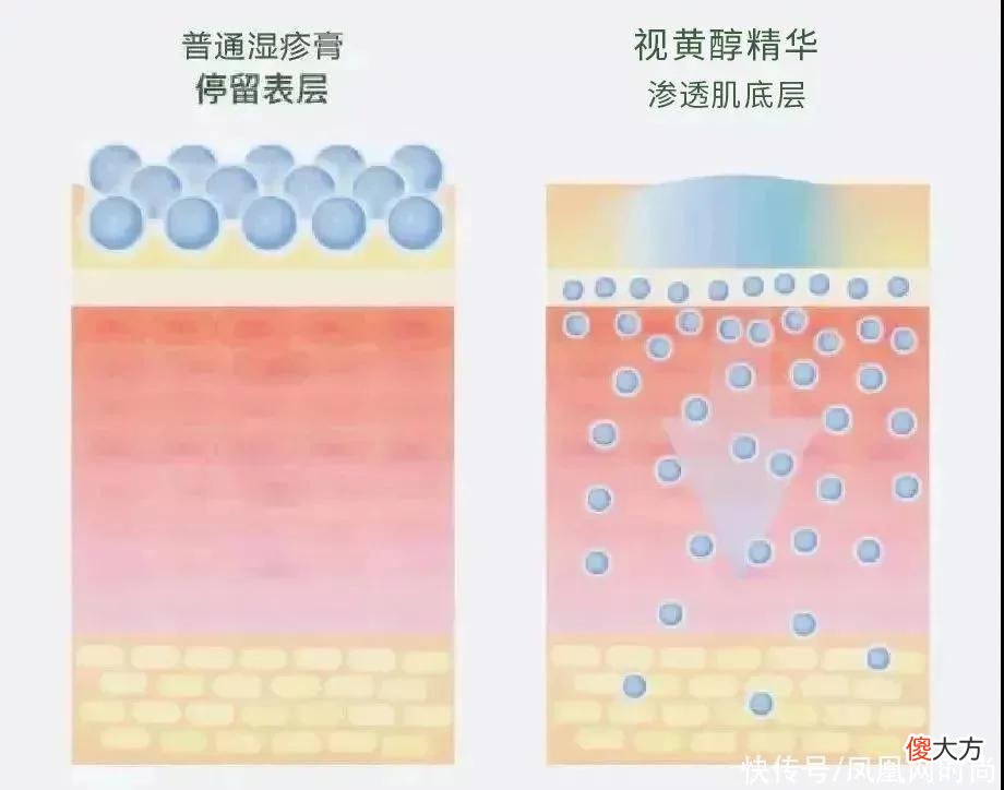 【就爱时尚】长了脂肪粒到底挤不挤？一分钟教你处理它的正确方式